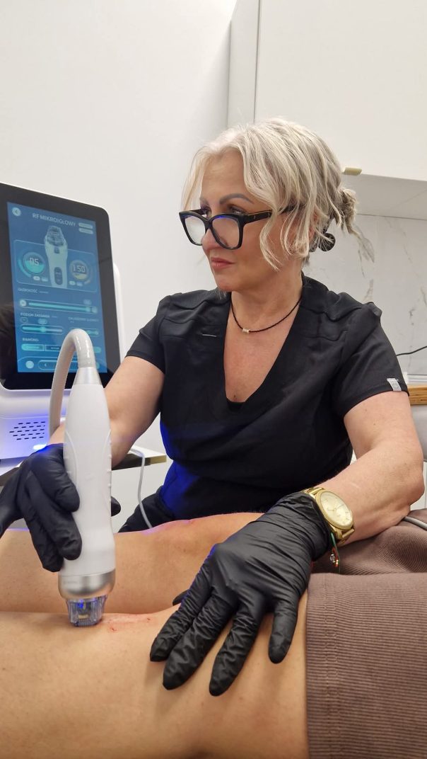 Radiofrekwencja Mikroigłowa w Gabinet Medycyny Estetycznej Wrocław Rosińska Beauty & Estetik